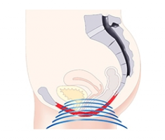 women-treatment-235x200-1 women-treatment-235x200-1