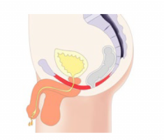 men-before-235x200-1