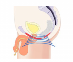 men-treatment-235x200-1